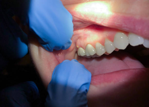 Best Root Canal Emergency Dentist  in St Pauls, NC